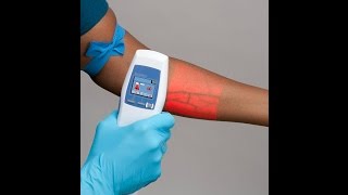 Accuvein AV400 vein finder جهاز طبي جديد للعثور على الأوردة [upl. by Rabka]