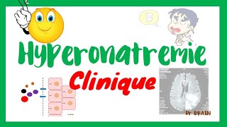 Hypernatrémie signes cliniques [upl. by Valina]