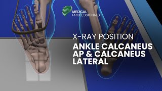 Xray Positioning Ankle Calcaneus AP and Calcaneus Lateral [upl. by Motteo999]