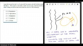 138 FA MECKELS DIVERTICULUM [upl. by Otxis]