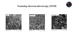 Scanning electron microscopy SEM Part 1 [upl. by Magnuson876]