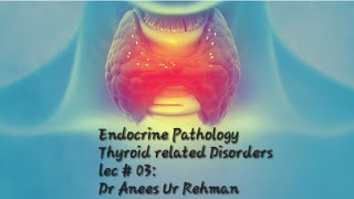 Goiter concept robbinsbasicpathology urdu thyroid [upl. by Mauchi622]