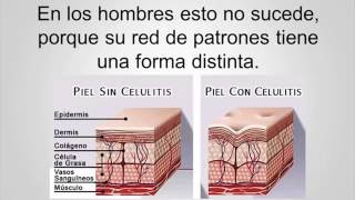 ¿QUÉ ES LA CELULITIS Y CÓMO SE FORMA MEJOR EXPLICADO [upl. by Puritan821]