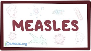 Measles  causes symptoms diagnosis treatment pathology [upl. by Middle]