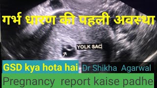 Gestational sac GShow to read pregnancy report yolk sac doctor home [upl. by Yankee]