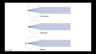 Emmetropia Hyperopia amp Myopia [upl. by Bartlett]