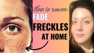 How to fade freckles on face naturally I Treatment for freckles on face frecklestreatment [upl. by Grochow]