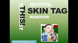 Revitol Skin Tag Removal  Remove Skin Tags Naturally [upl. by Saltsman]