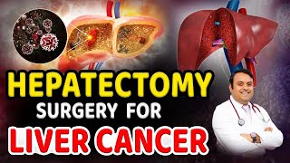 Liver Cancer Hepatectomy Surgery  Cancer  Liver  Liver cancer treatment  DrSatish  Kaizen [upl. by Ignacia821]