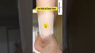 🔥Get Fair Feet  Easy Suntan Removal Pack At Home RemoveSuntan shortsytshortssuntandiyviral [upl. by Atirahc874]