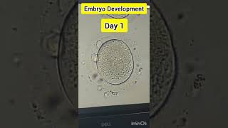 Embryo development process in IVF embryology embryodevelopment embryologist ivf ivfprocess [upl. by Cela]