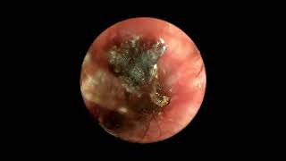 Ear Mites Inside Dog’s Ear Canal Video Otoscopy [upl. by Mars85]