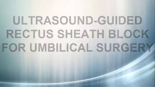 ULTRASOUND GUIDED RECTUS SHEATH BLOCK FOR UMBILICAL SURGERY [upl. by Combes]