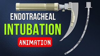 ENDOTRACHEAL INTUBATION  ANIMATION  PEDIATRICS [upl. by Theresina]