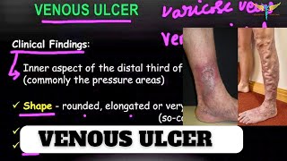 Venous Ulcer  Varicose Ulcer  General Surgery  Easy Video Lecture  Knowing Anatomy [upl. by Pinzler]