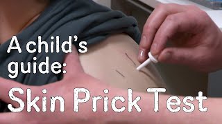 A childs guide to hospital Skin Prick Test [upl. by Sharma]