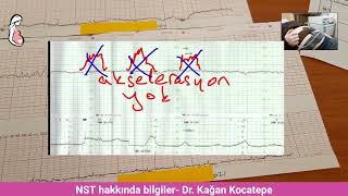 NST nonstrestest ile rahim kasılmaları ve bebeğe giden kan akımının kalitesi nasıl anlaşılır [upl. by Tristis]