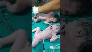 First cry baby at birthmaa shortvideo baby cutebaby status babyvideos cute nurse touching [upl. by Iarised]