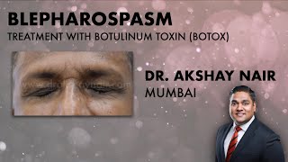 Understanding Blepharospasm Treatment  Botulinum Toxins Dr Akshay Nair Mumbai [upl. by Uriiah]