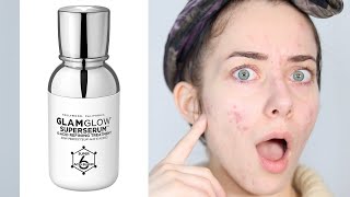 GLAMGLOW SuperSerum 6Acid Review  First Impressions  Skincare [upl. by Aryk]