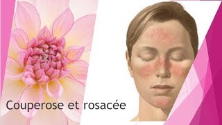 Couperose et rosacée comment soigner [upl. by Hansel]