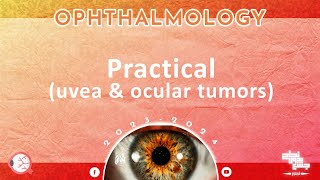 Pract Uveal tract disorders and ocular tumors Ophthalmology [upl. by Ramonda]