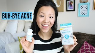 TREATING HORMONAL ACNE ft Loma Lux  nowampjenn [upl. by Htaeh908]