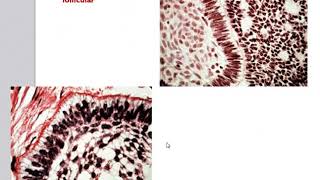 Odontogenic Tumors [upl. by Blasien]