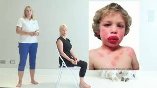 Top Tips for Anaphylaxis  First Aid [upl. by Acinomahs572]