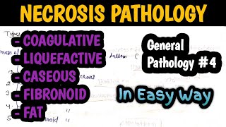 Necrosis Pathology  Types of Necrosis  Cell injury pathology  General Pathology 4 [upl. by Nura86]