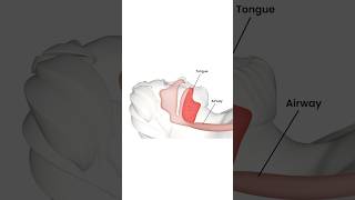 What is Obstructive Sleep Apnea  Capital ENT amp Sinus Center [upl. by Uhile486]