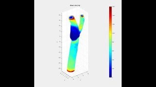 QuickerSim CFD Toolbox for MATLAB®  Blood Flow Modelling [upl. by Llyrat]