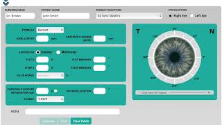 Alcon Online Toric IOL Calculator Instructional Video Updated 012918 [upl. by Jilleen]