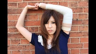 美女の腕ギプス long arm cast in Kobe JAPAN [upl. by Gnouv]