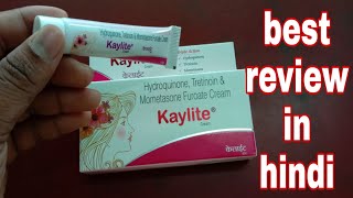 kaylite cream best review in hindi गोरा हो जाइए बस कुछ ही दिनों में [upl. by Schuster765]