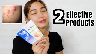 SKINCARE ROUTINE FOR OILY AND ACNE PRONE SKIN PHILIPPINES [upl. by Shrier190]