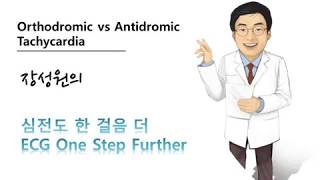 심전도 한 걸음 더 20 정방향 역방향 방실회귀빈맥 orthodromic antidromic AVRT [upl. by Kalin]