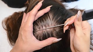 ASMR Intense Scalp SCRATCHING and NITPICKING with Nails Real Person [upl. by Ihsoyim442]