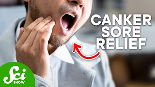 How to Get Rid of Canker Sores According to Science [upl. by Brien]