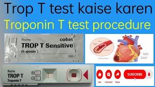 Trop T test kaise karen  Troponin T test procedure  Trop T blood test kaise kare [upl. by Tertius]