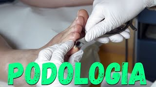 PODOLOGIA LIVE  Como tratar um Granuloma  CURSO Fórmula Podologia de Sucesso [upl. by Bonnie]