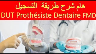 هام شرح طريقة التسجيل DUT Prothésiste Dentaire FMD [upl. by Aidekal539]