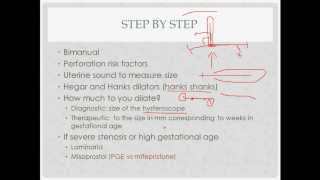 dilation and curettage  description indications and questions [upl. by Friedland]