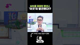 MRI를 꼼꼼히 봤더니 이것이 발견됐다 방광암 [upl. by Lleryd]