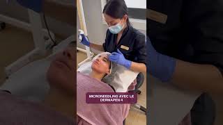 MICRONEEDLING DERMAPEN 4 le traitement esthétique qui améliore le grain de peau Clinique ReGeneva [upl. by Nuahc]