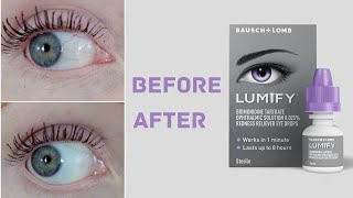 Lumify Eye Drops  Honest Review  Safe for Sensitive Eyes [upl. by Assiruam]