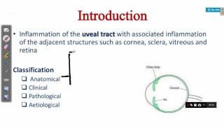 OPHTHALMOLOGY LECTURES diseases of uveal tract UVEITIS [upl. by Pavier]