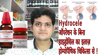 Hydrocele  Homeopathic medicine for Hydrocele  explain [upl. by Zack]