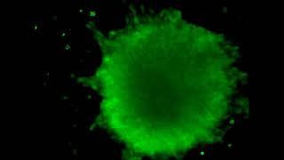 Neuronal firing in different mouse primary neural stem cell spheres visualized by calcium imaging [upl. by Doownelg]