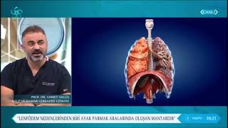 Dolaşım bozukluğu Tromboflebit DVT neden en çok bacak ayaklarda olur  Prof Dr Ahmet AKGÜL [upl. by Aissak]